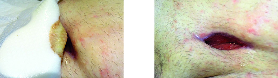 220_Conformability BS Multishape MIXED IMAGES.jpg